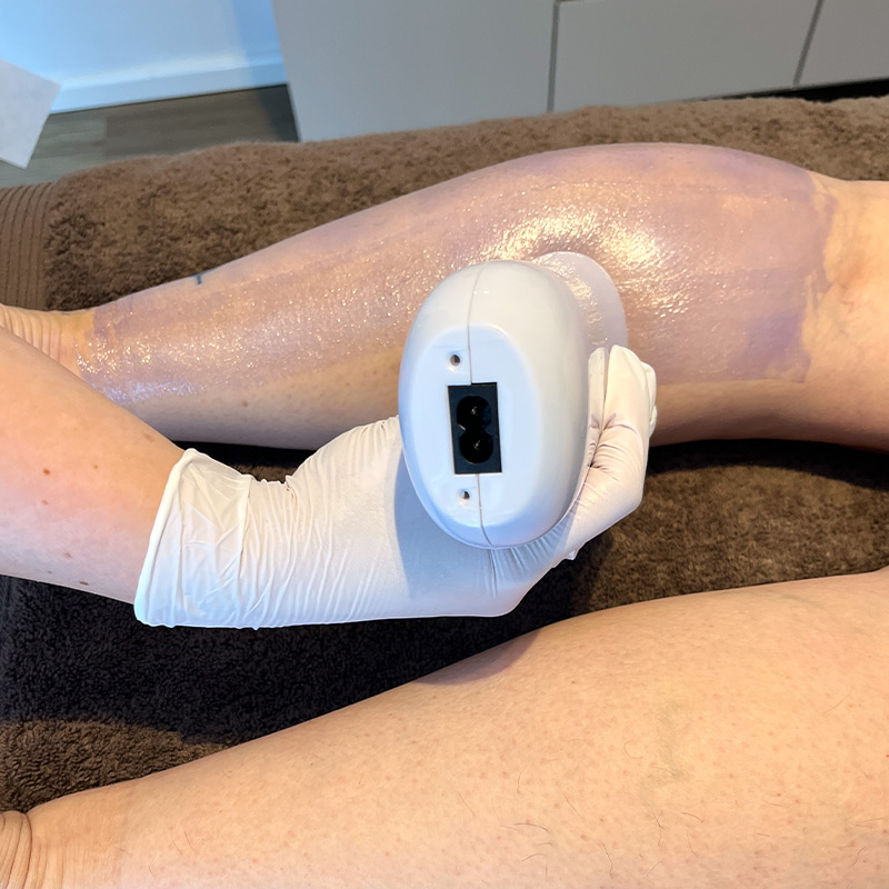 Behandlung